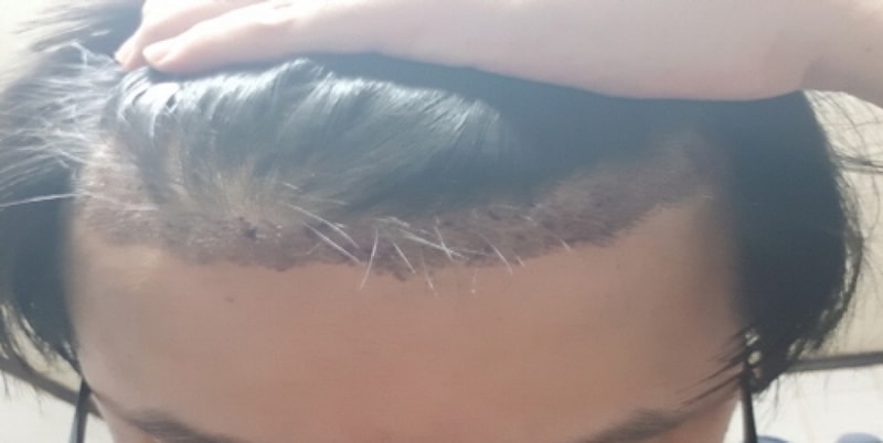 [크기변환][크기변환]위.jpg
