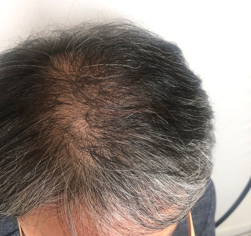 6개월 after.jpg