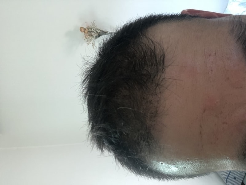 사천모 사개월차 입니다 암흑기가 오지 않음