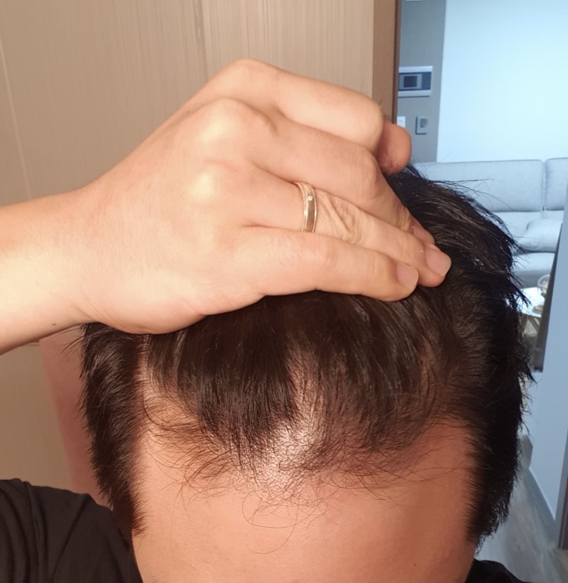 7개월 다나 무삭발 결과