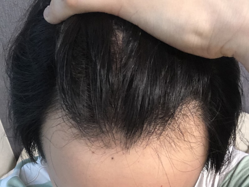 다나 6개월!