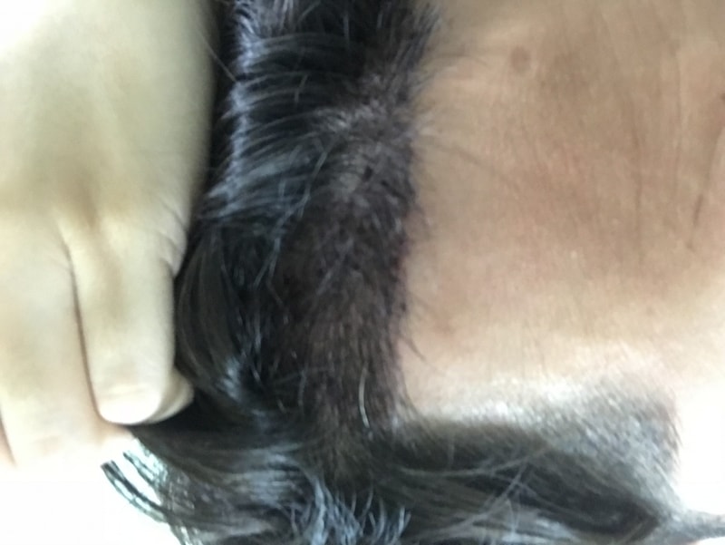 뉴헤어 3일차인데 밀도 괜찮아 보이나요?