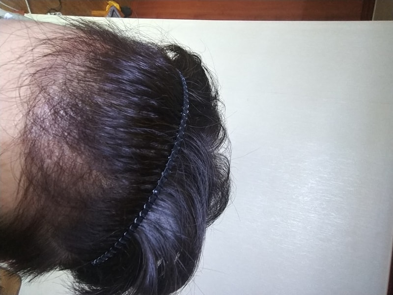 20180918_112010_HDR.jpg