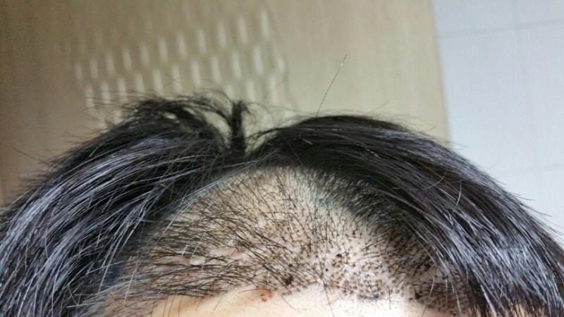7일차 좌측.jpg