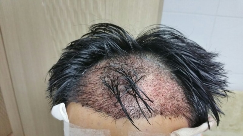수술 당일.jpg