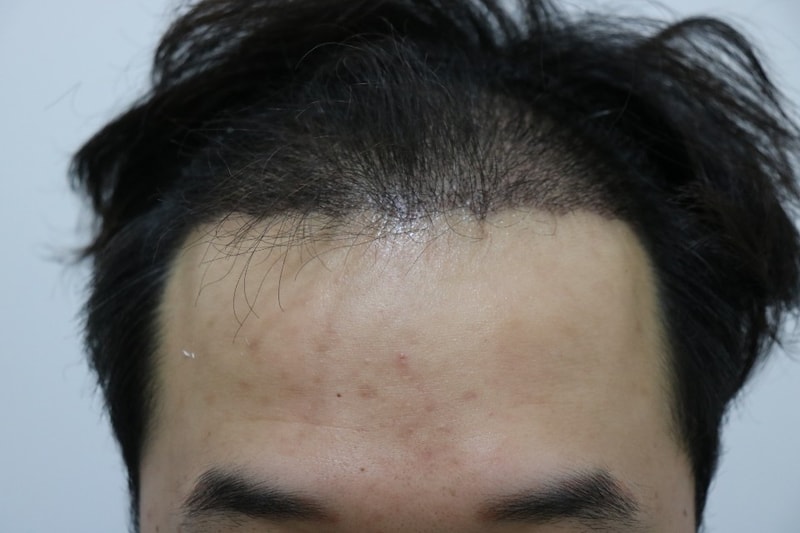 수술후2.jpg