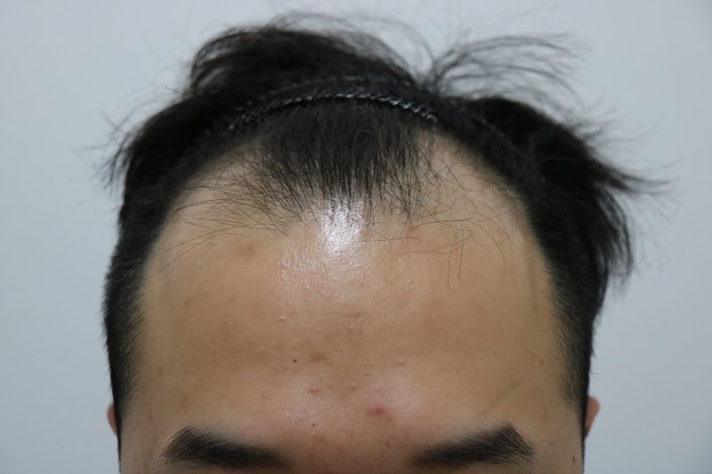 수술전2.jpg