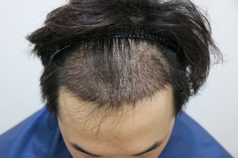 수술후.jpg
