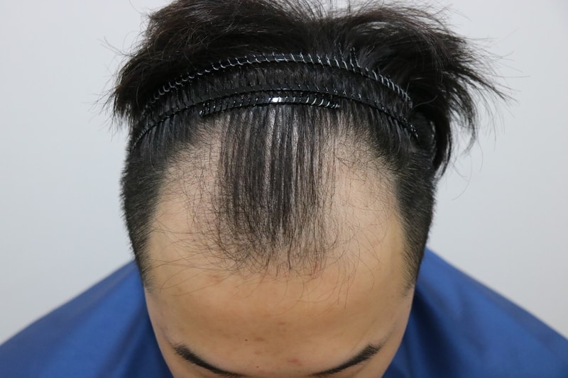 수술전1.jpg