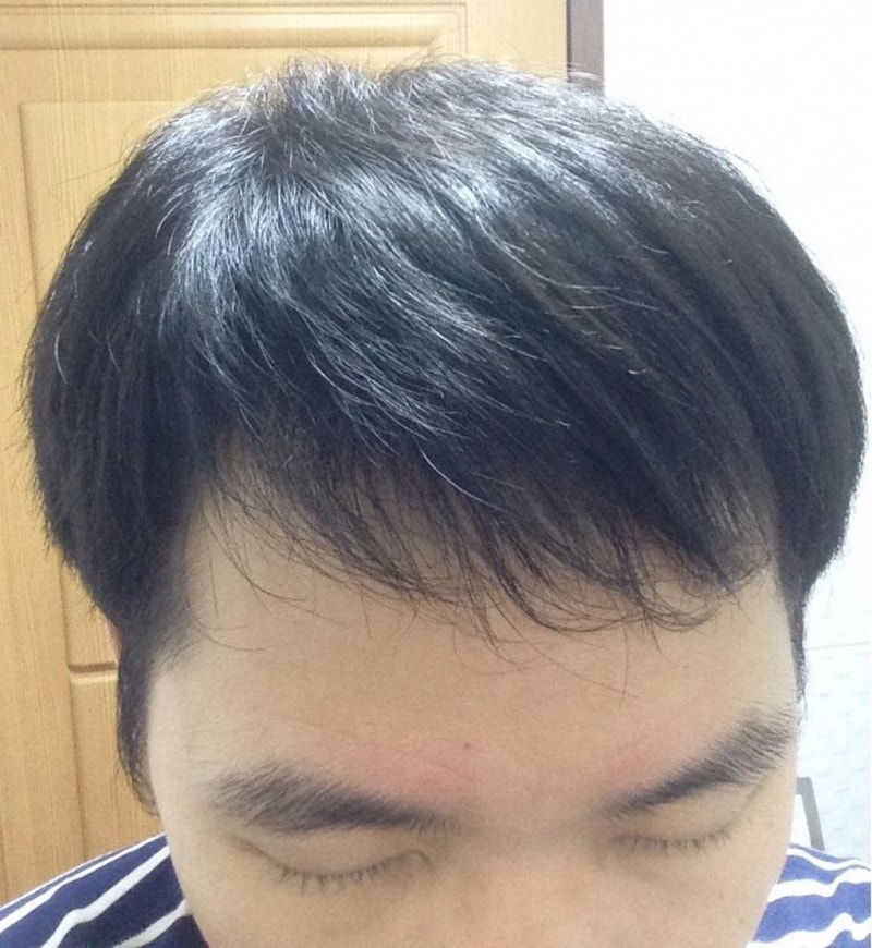 정면 상단.jpg