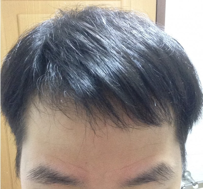정면 가르마 머리내림.jpg