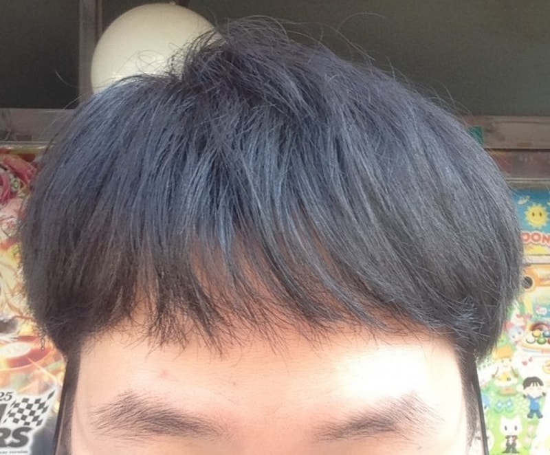 머리 정면.jpg