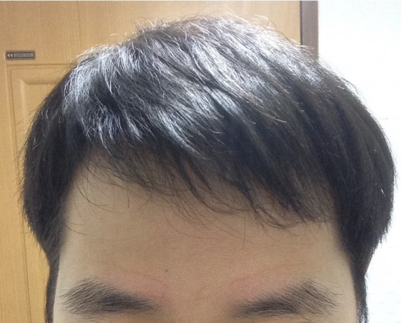 정면 내린 상태.jpg