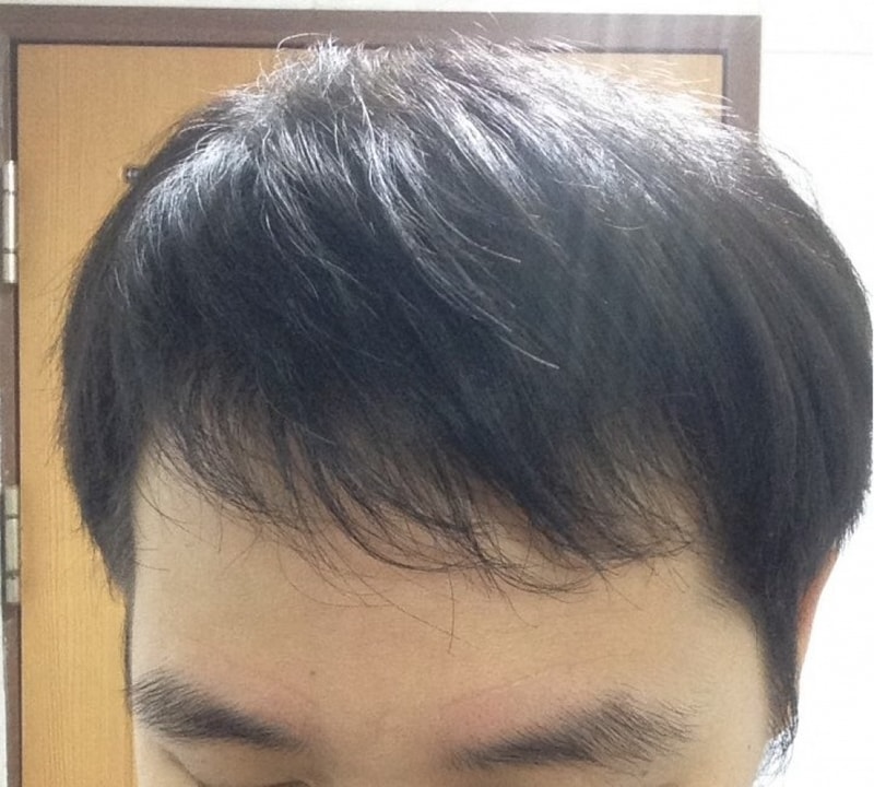 정면 기울임.jpg