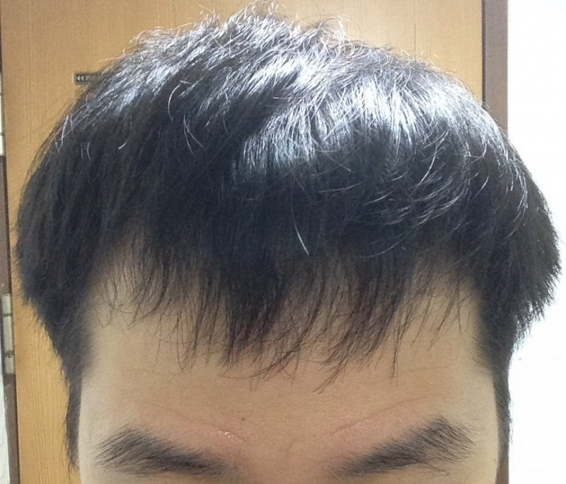정면 그냥 머리내림.jpg