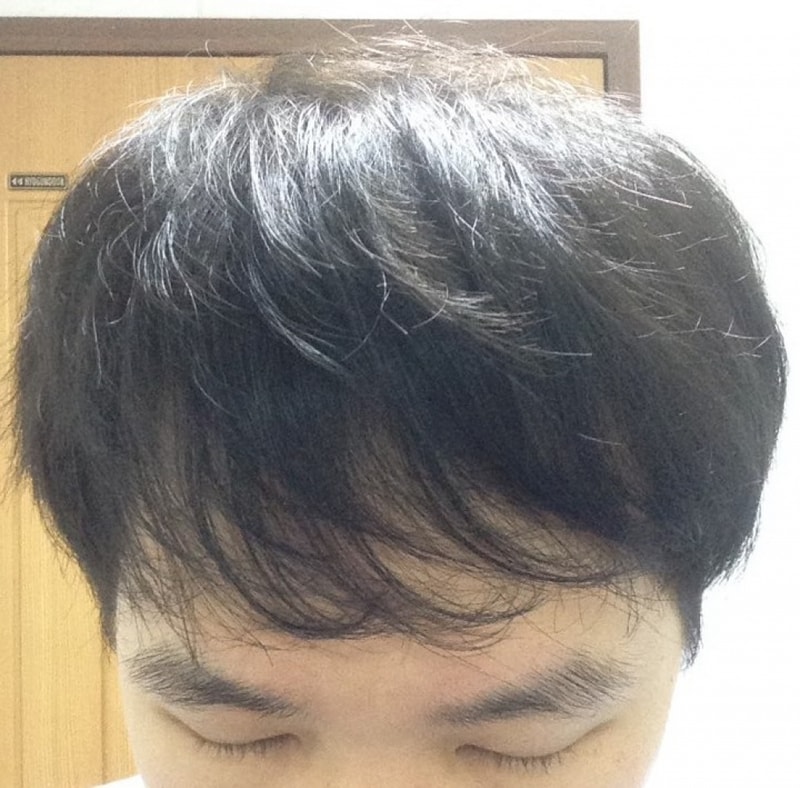 전두부.jpg