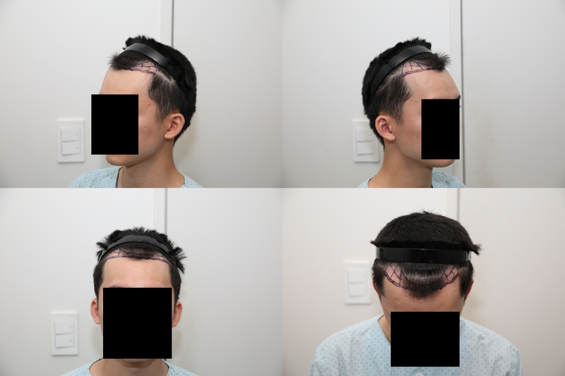 before.png
