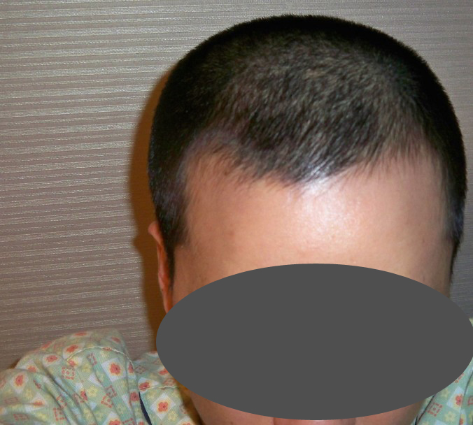 수술전 사본.jpg