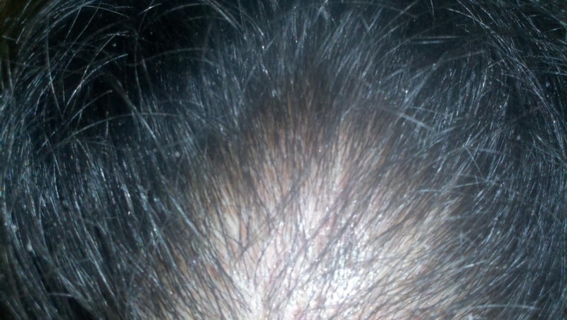 2011-07-17_10-07-09_5300000.JPG