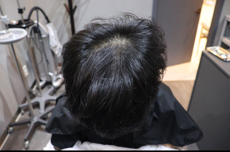 Review of Gwangju Apgujeong Mobiang Surgery