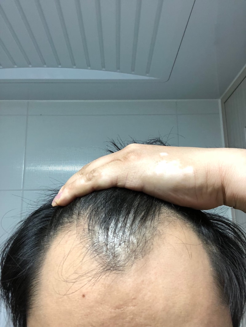 광주 압구정 모비앙 6개월 후기입니다.