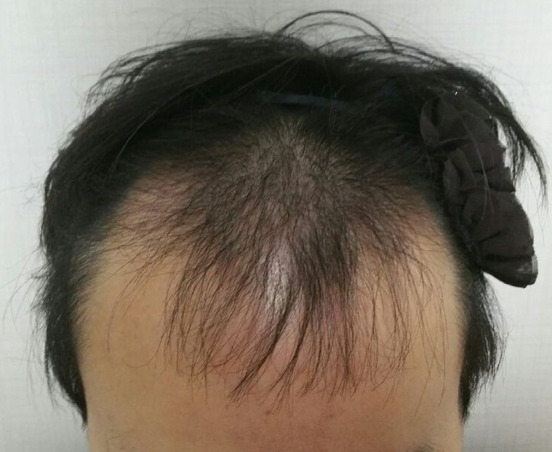 3개월.jpg