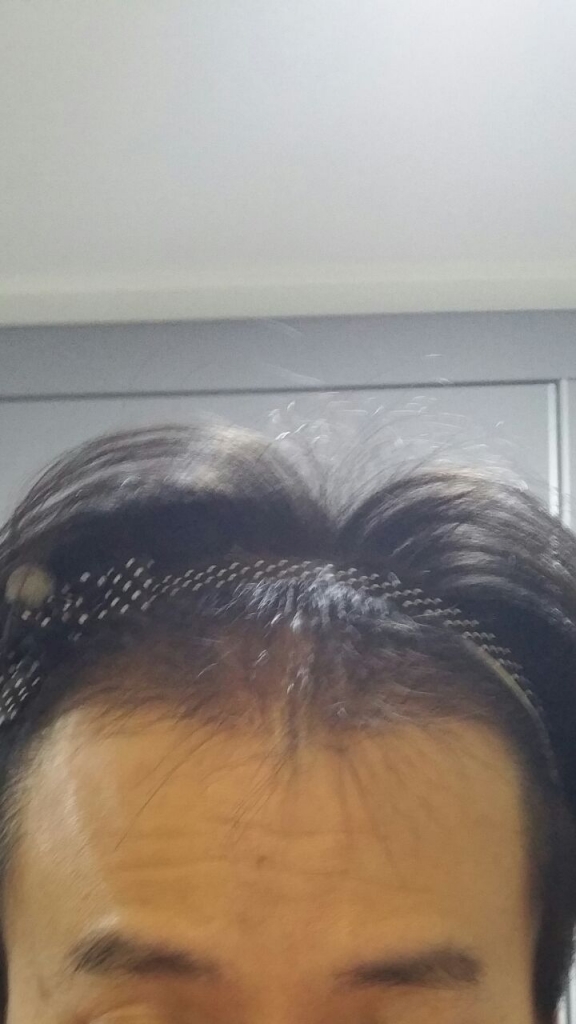 5개월 #2.jpg
