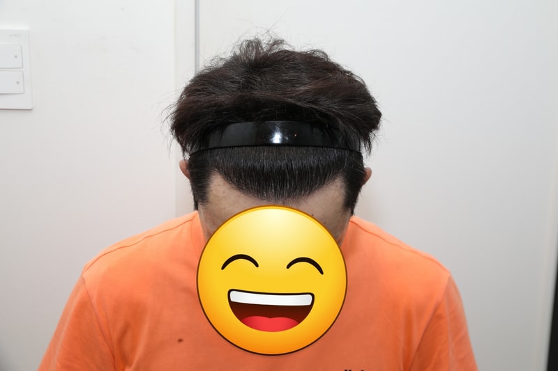1900모낭 1년 1개월차 후기