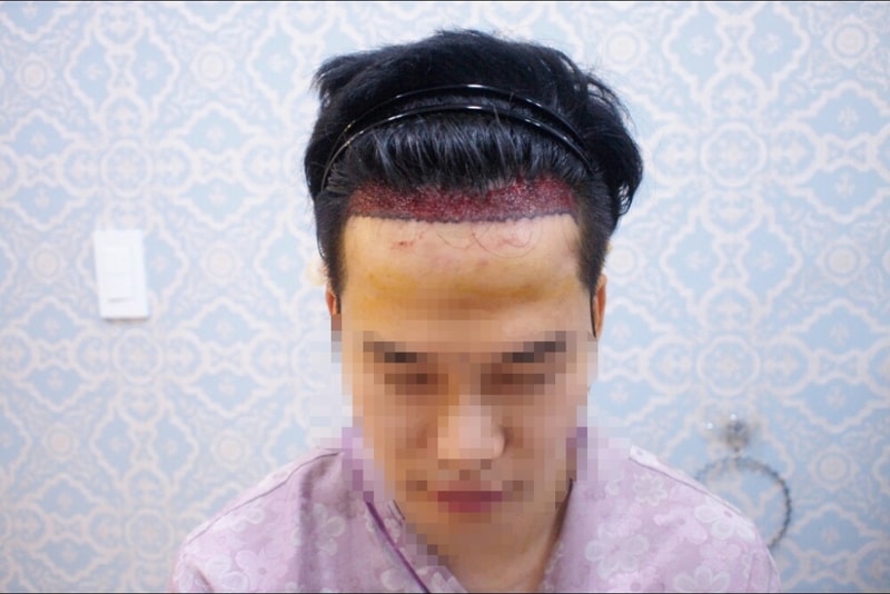 KakaoTalk_20160906_173448695.jpg