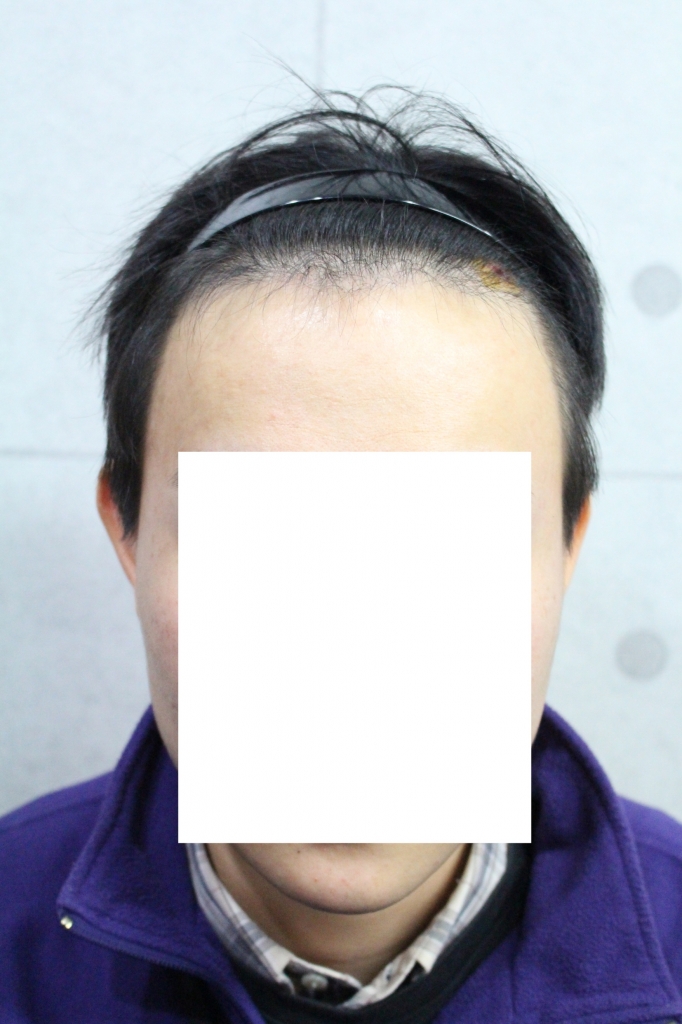 크기변환_IMG_3663.JPG
