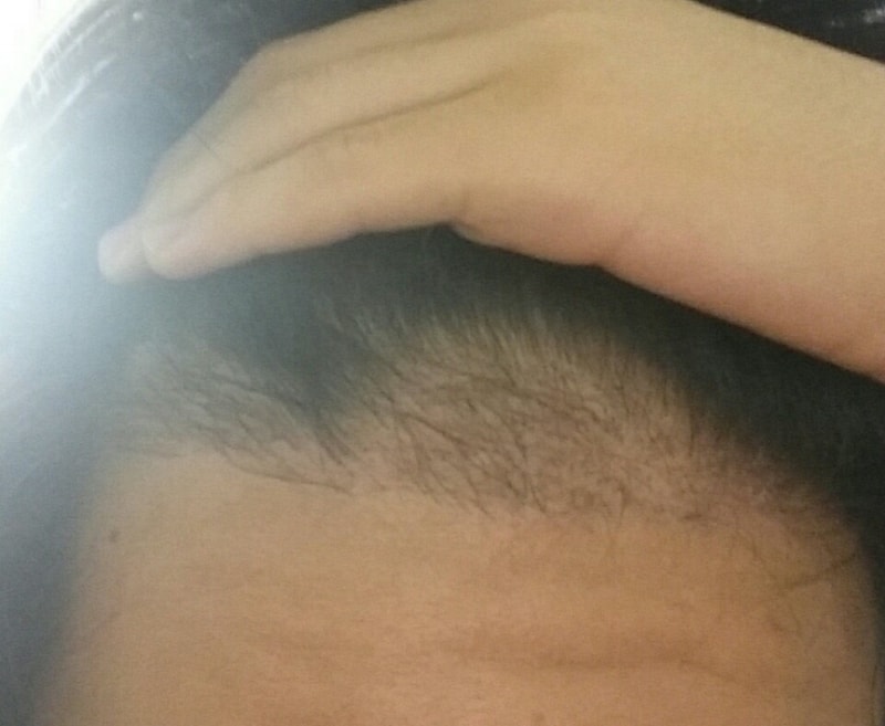 March 10th Motion 4 Month Late 800 Follicular Review