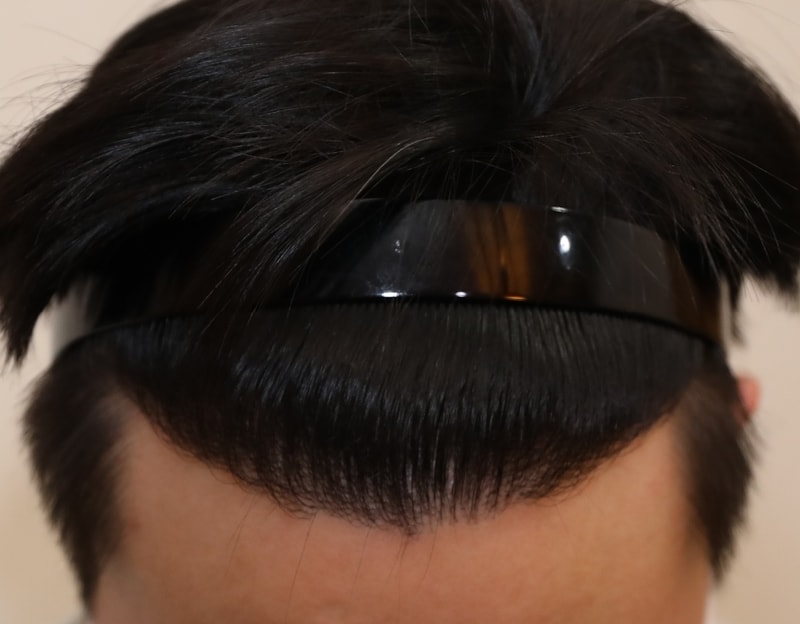수술후 1.jpg