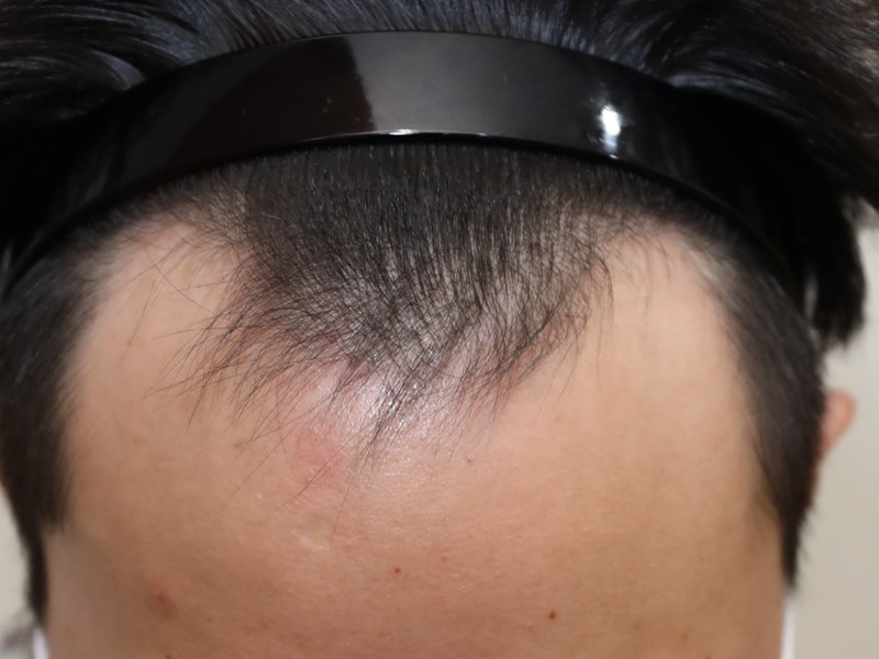 수술전 1.jpg