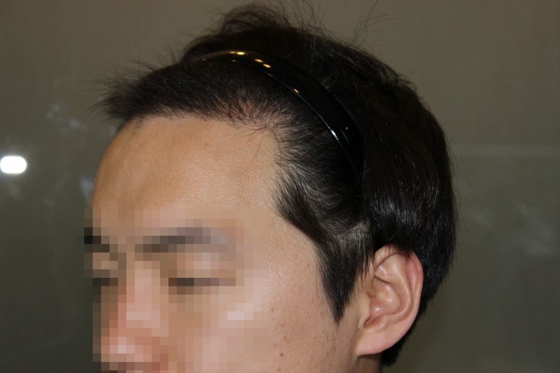 16-821203장윤혁__#148 (왼쪽측면).jpg