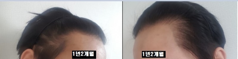 1년개월 옆.jpg