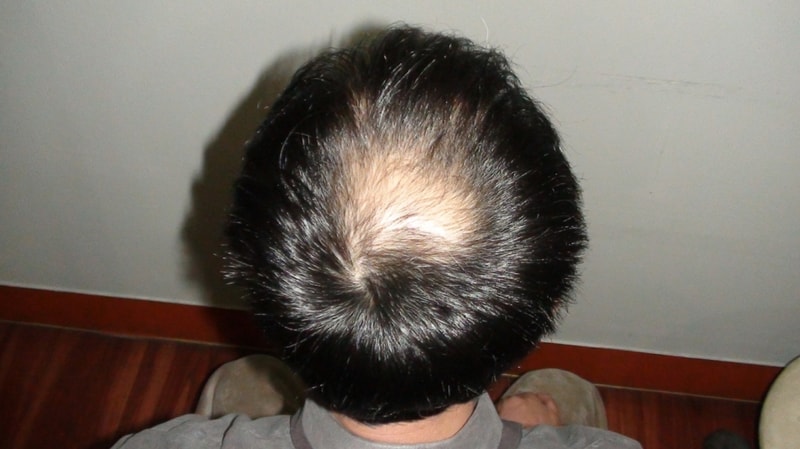 수술전.JPG