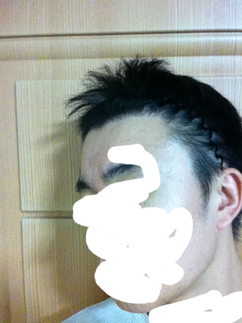 9개월 좌측.jpg