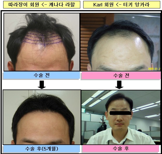 비교-1.jpg