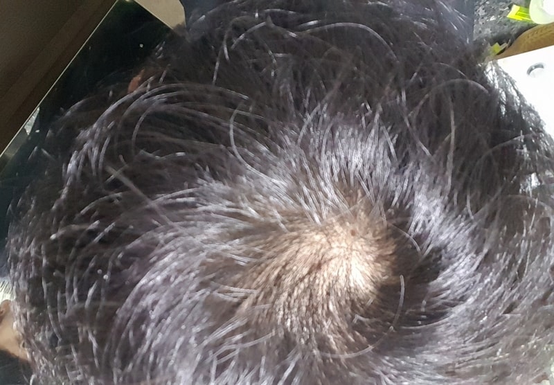 20170128_203617.jpg