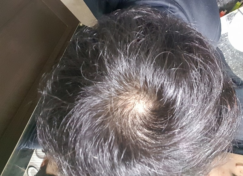 20170128_203611.jpg