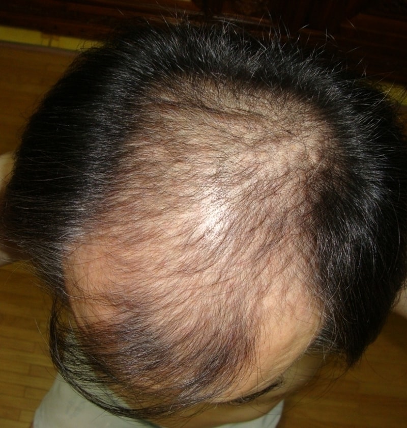 201110월 이식전.jpg