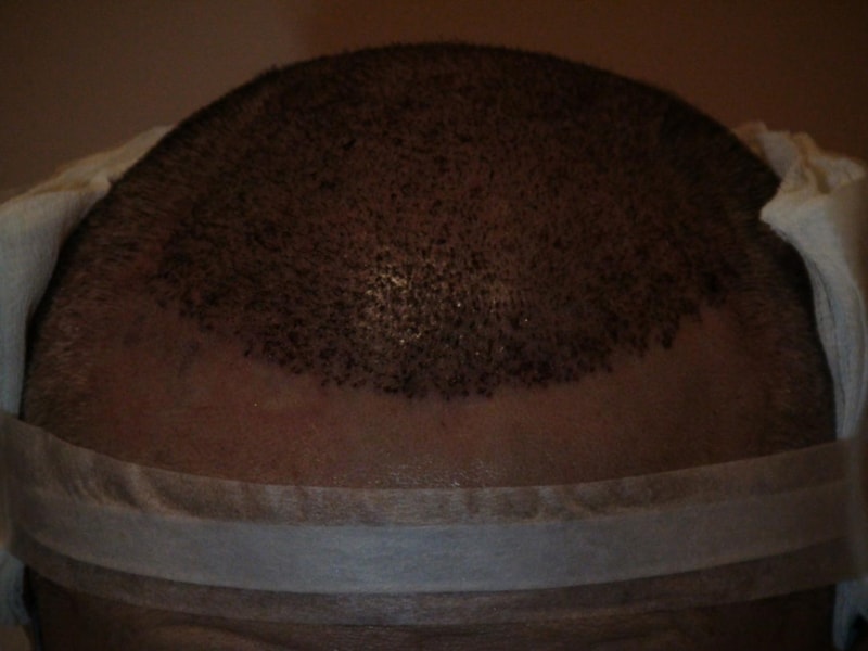 20111118 이식당일-2.JPG