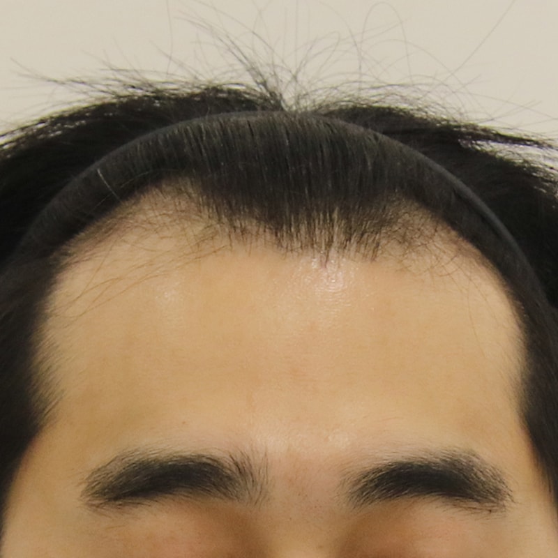 01.수술전1.jpg