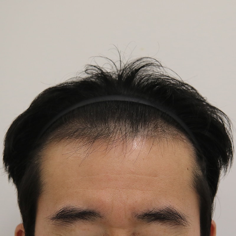 수술 전1_송용웅님.jpg