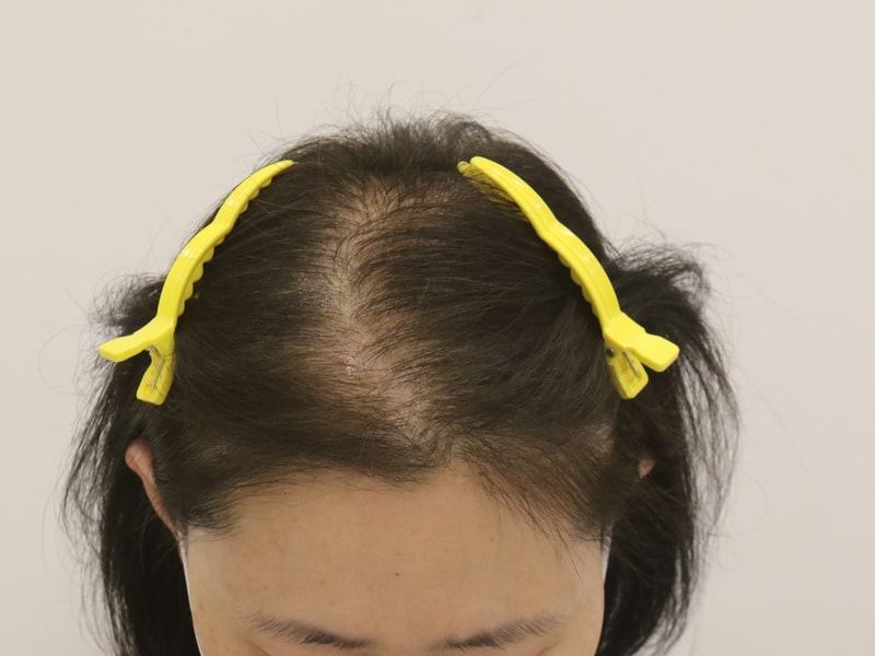1.JPG