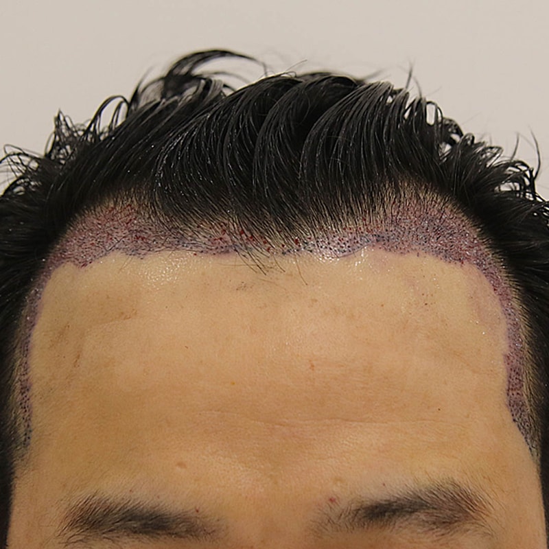 수술 직후1.jpg