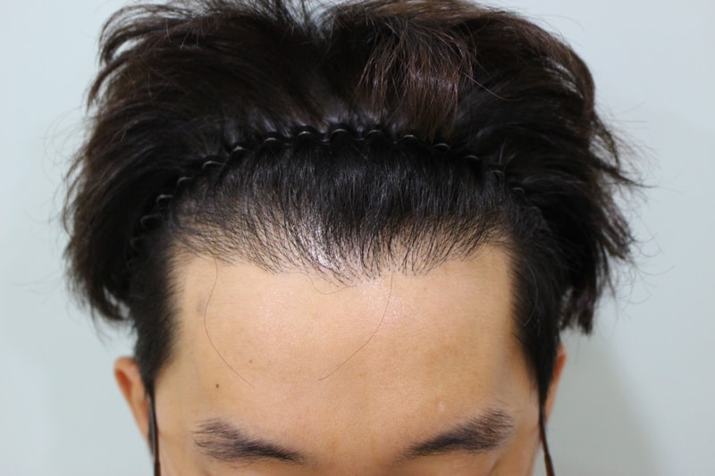 KakaoTalk_20180810_170641466_mini (1).jpg