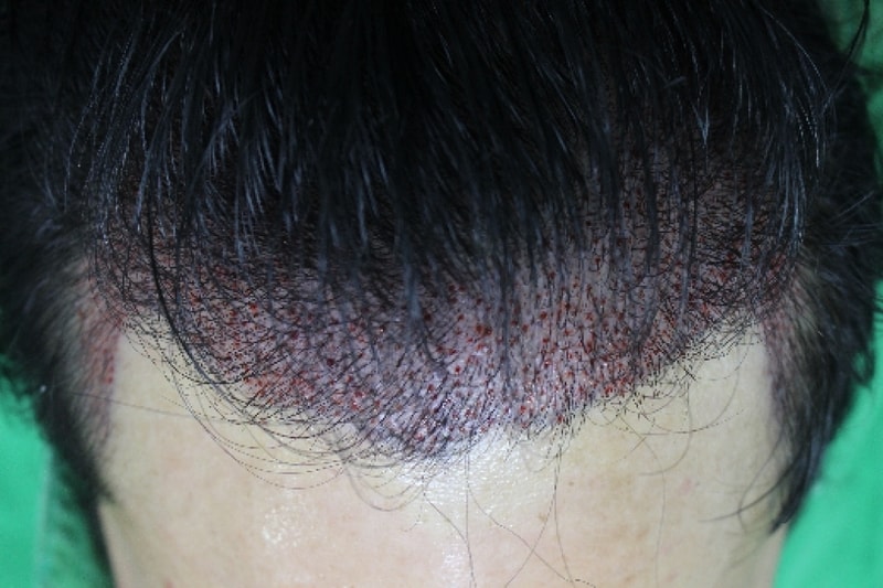 수술중1.png