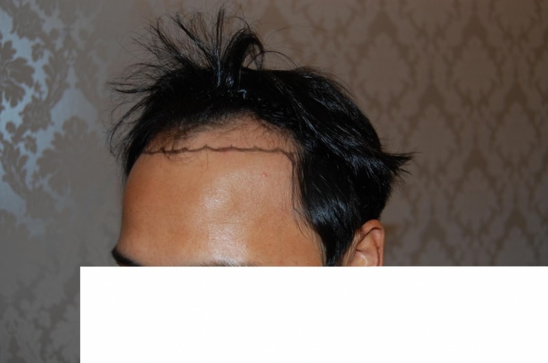전 오른쪽.JPG