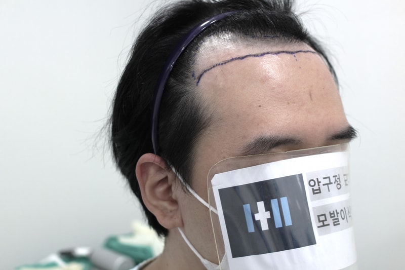 모더함의원 14일차 후기입니다